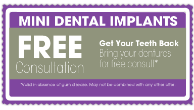 mini-implants-coupon