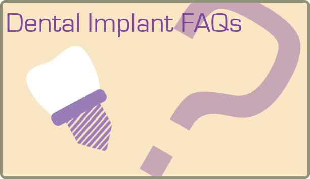 canton-dental-implant-faqs
