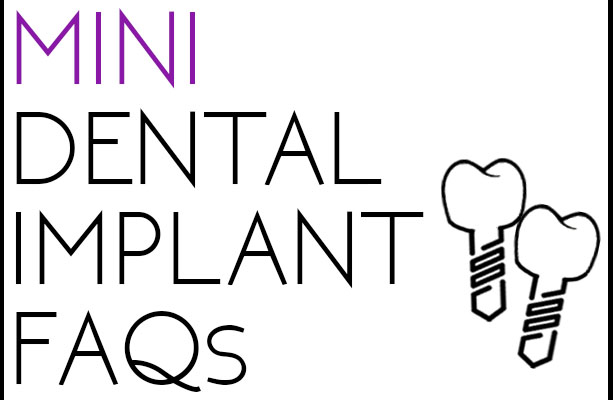 mini-dental-implant-faqs