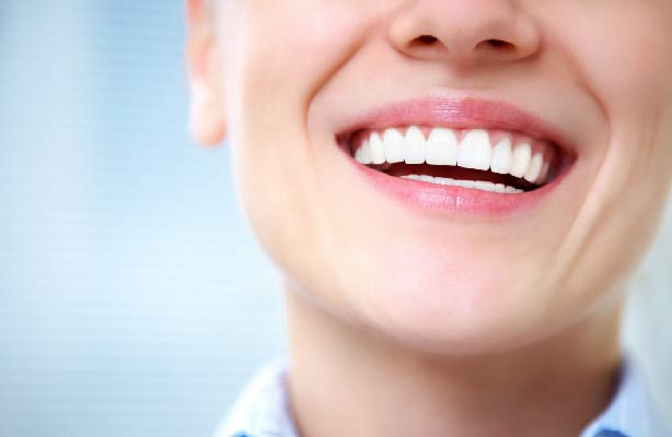 professional teeth whitening in canton