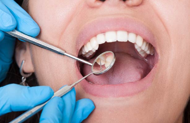 dentist tool examining woman's mouth