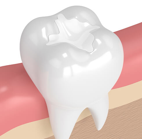 restorative dentistry