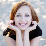 young woman leaning her chin on her hands smiling to show off her braces