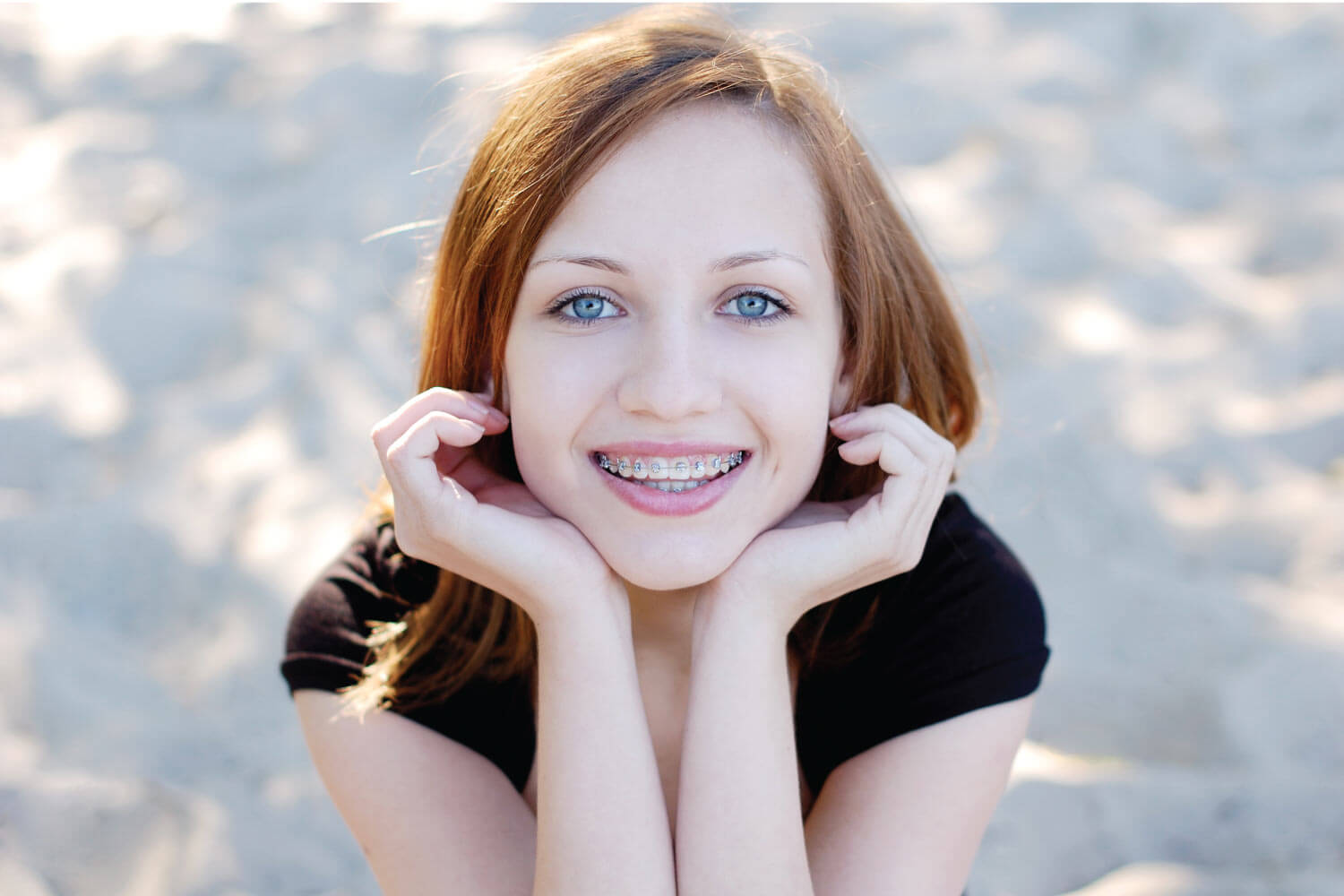 young woman leaning her chin on her hands smiling to show off her braces