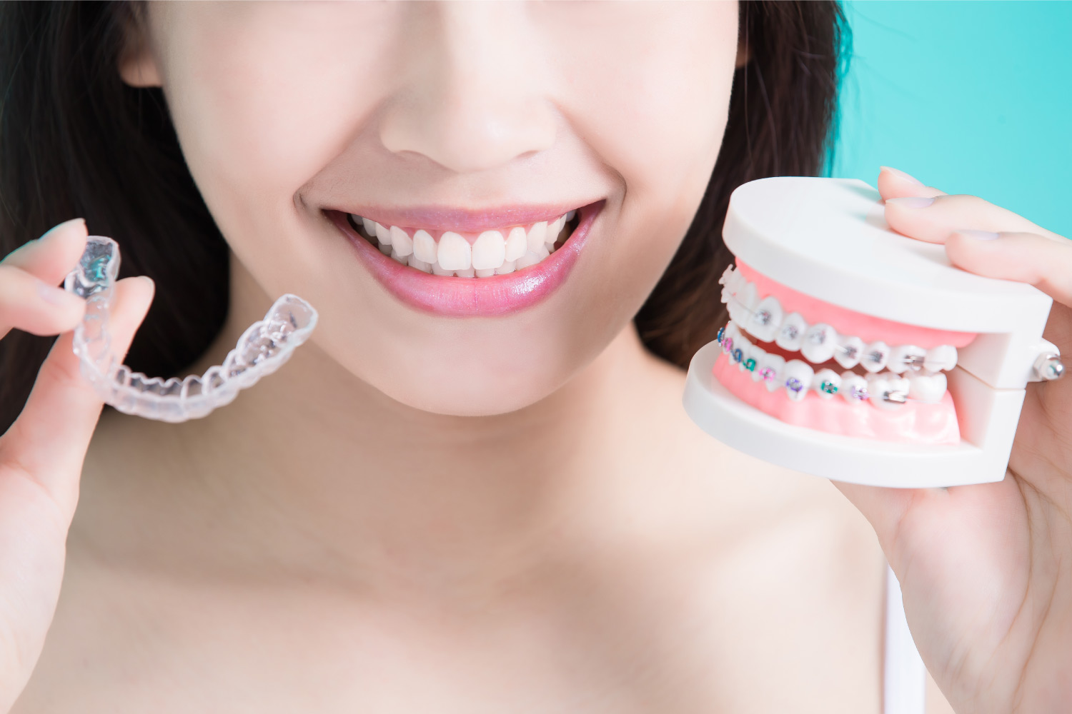 Woman holds Invisalign aligners and braces to compare the two orthodontic treatments