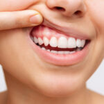 Closeup of a woman pulling back her lips to show healthy gums