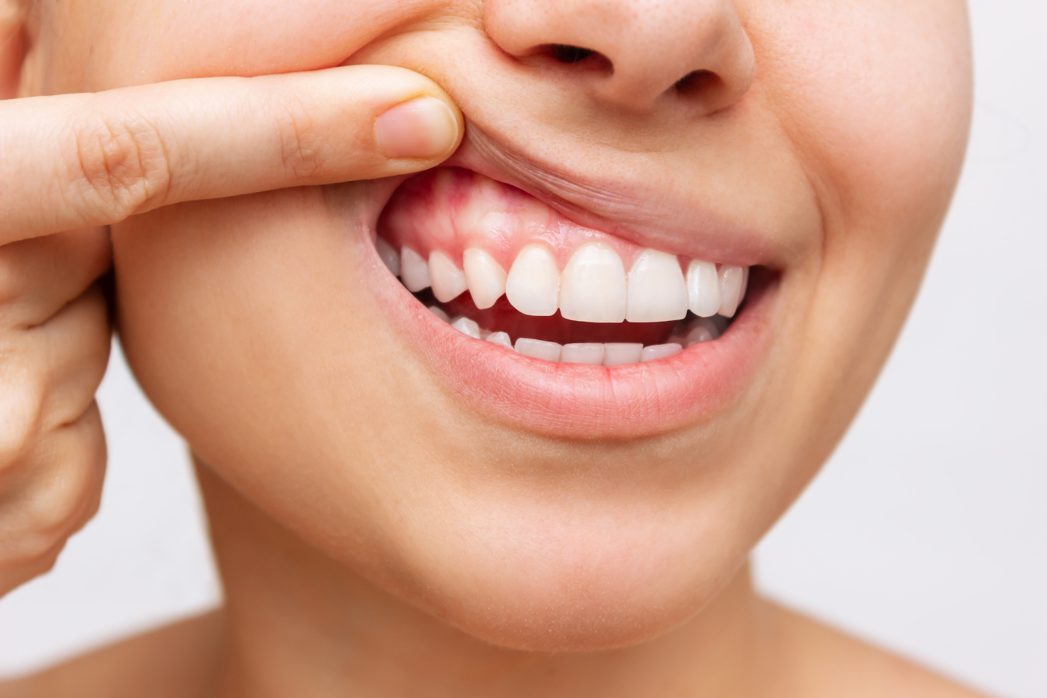 Closeup of a woman pulling back her lips to show healthy gums