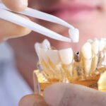 closeup of hands holding and manipulating a dental implant model