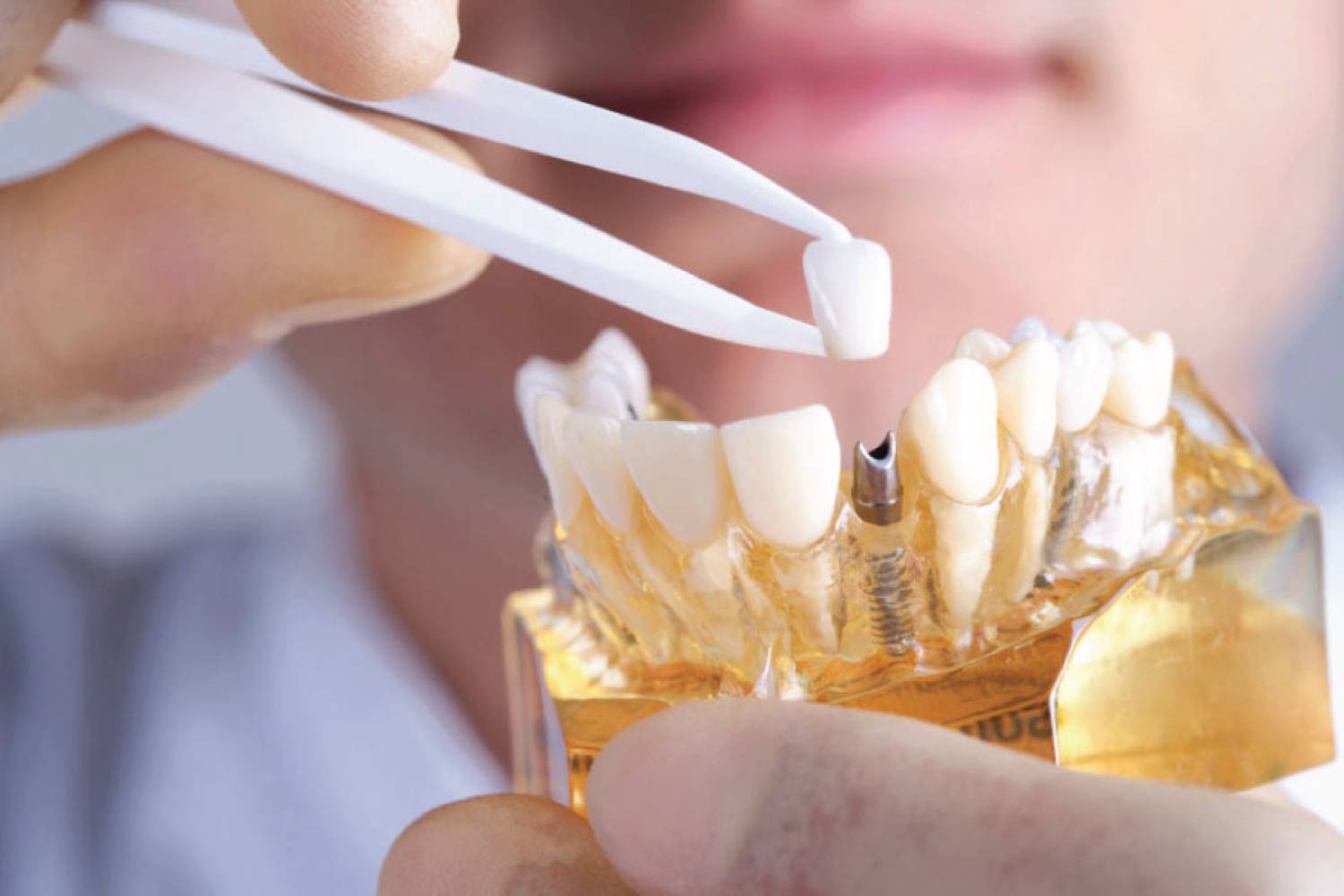 closeup of hands holding and manipulating a dental implant model