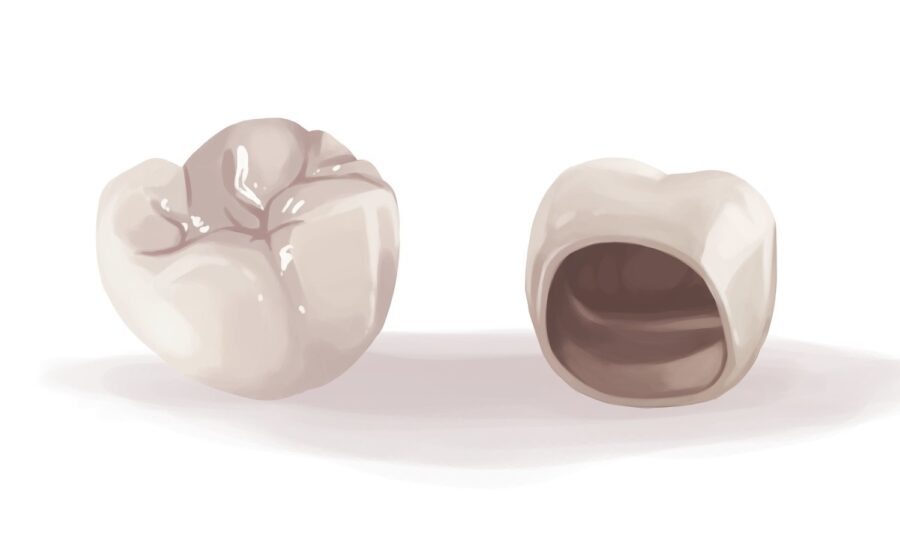 zirconia crown for implant crown restoration