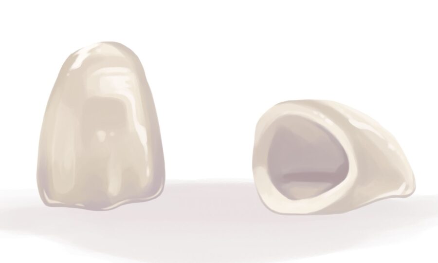 ceramic crown for implant crown restoration