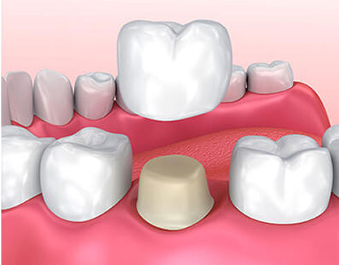 illustration of crowns